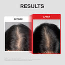Folligen Thickening Scalp Serum